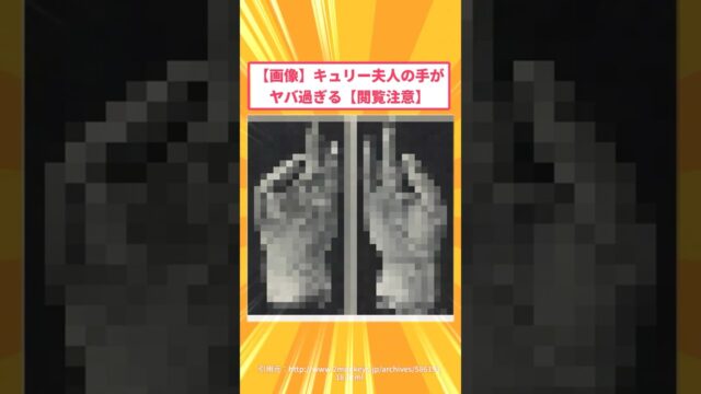 【画像】キュリー夫人の手がヤバ過ぎる【閲覧注意】